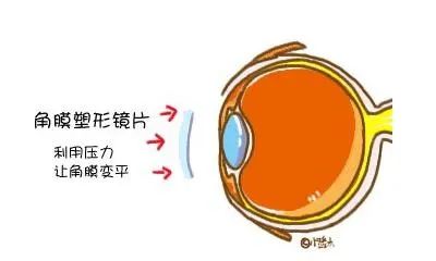 进出口眼镜报关如何归类？